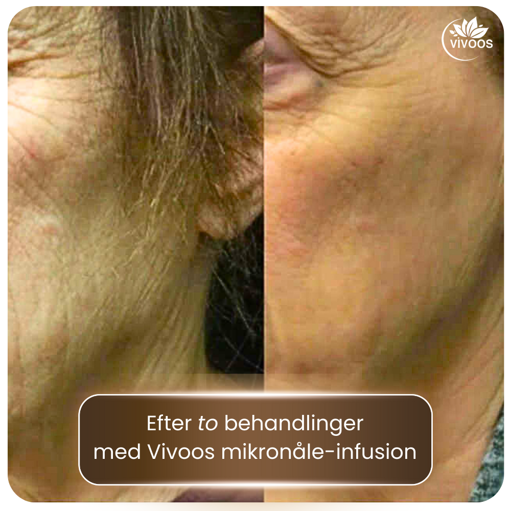 Øget fasthed og naturlig glød